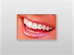 Clínica Dental Ángel Frías CLINICAS DENTALES Clínica Dental Ángel Frías CLINICAS DENTALES