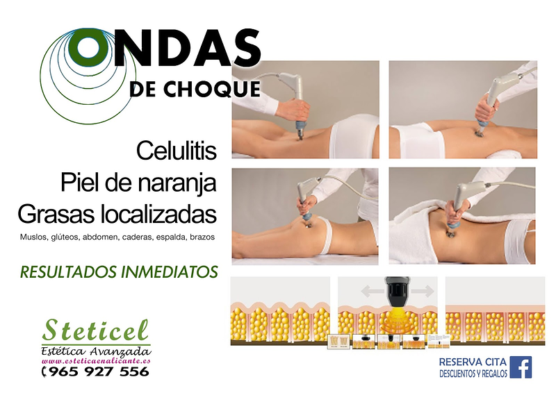 Javier Peluqueros - Navia 14