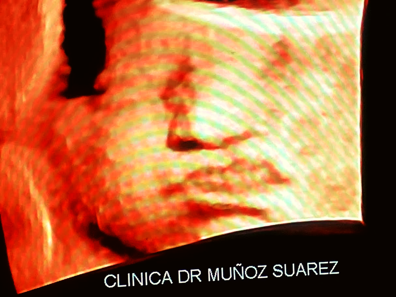 Manuel Mu&ntilde;oz Su&aacute;rez 2