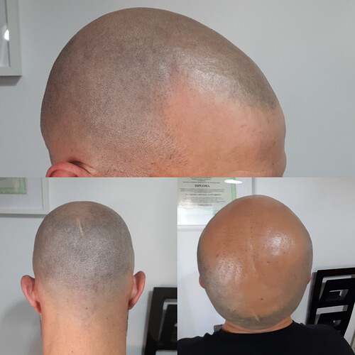 Bloom Studio Micropigmentaci&oacute;n Integral 5