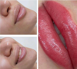 Galería de imágenes