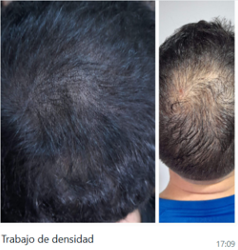 Bloom Studio Micropigmentaci&oacute;n Integral 10