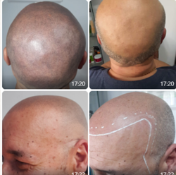 Imagen de Bloom Studio Micropigmentación Integral