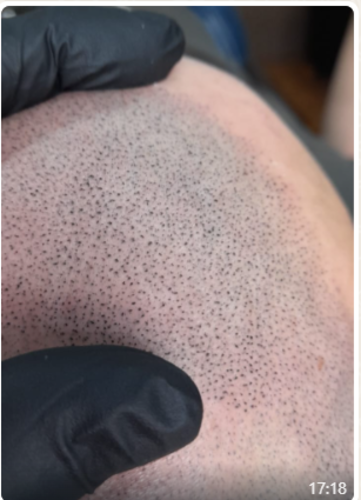 Bloom Studio Micropigmentaci&oacute;n Integral 9