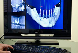 Clínica Dental Ilerdent 4 Clínica Dental Ilerdent 4