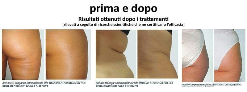 Est&eacute;tica Alis 11