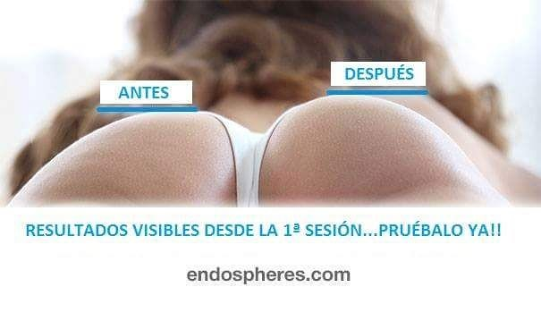 Est&eacute;tica Alis 2