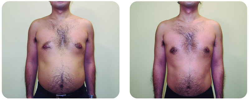 Est&eacute;tica Alis 5