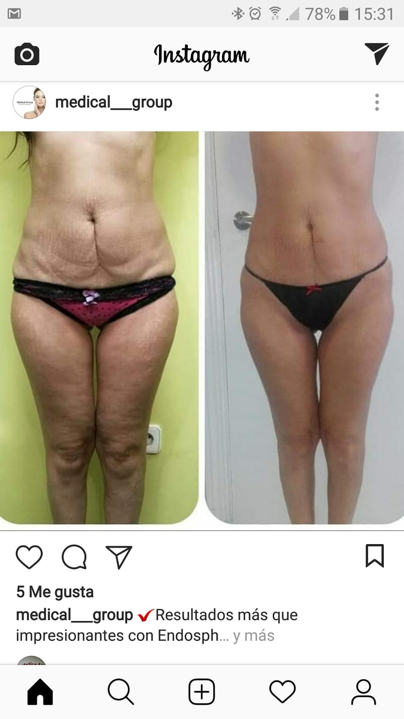 Est&eacute;tica Alis 4