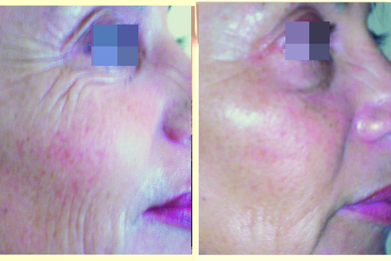 Est&eacute;tica Alis 13