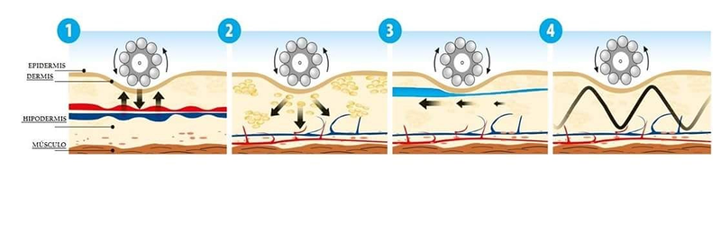 Est&eacute;tica Alis Zaragoza