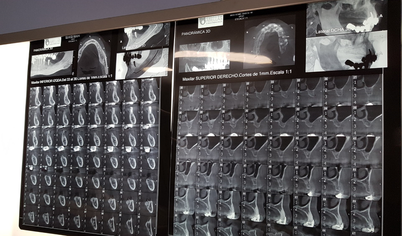 Dr. Agustín Marquina "Clínica Dental Torrecedeira" 5