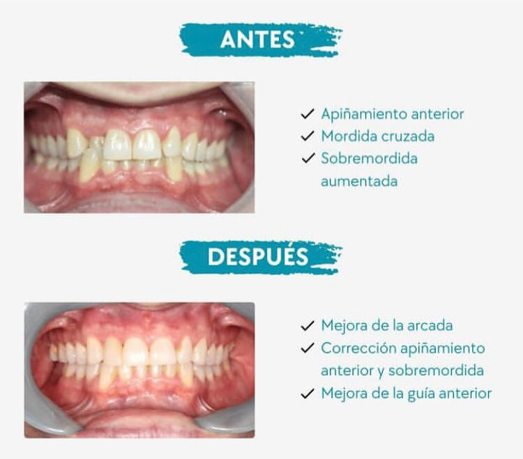 Cl&iacute;nica Dental Dr. Alfredo Delgado 4