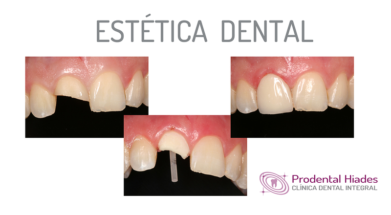 Prodental Hiades 9