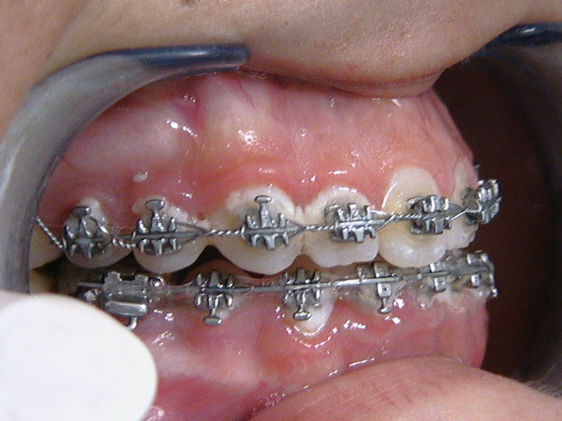 Cl&iacute;nica Dental Oscar Neme 4