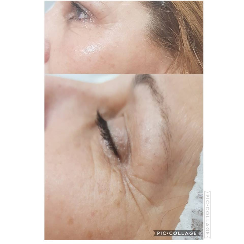 Bliss Est&eacute;tica y Salud 3