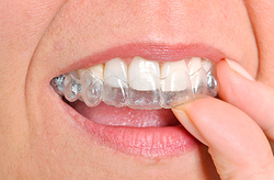 Solucion Dental Identalitas Valdemoro Solucion Dental Identalitas Valdemoro