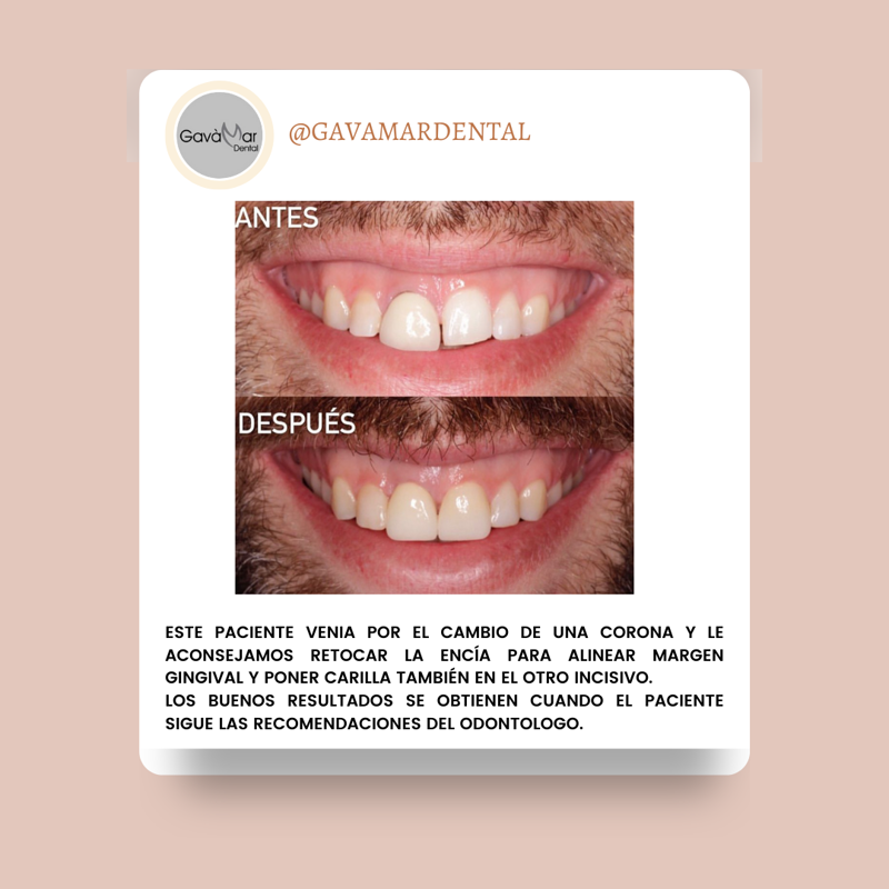 Clínica Dental Gavà Mar 11