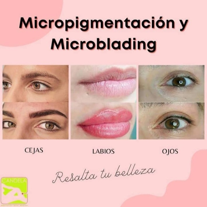 Candela Depilaci&oacute;n Las&eacute;r 4