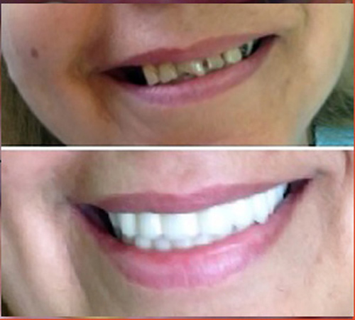 Clínica Dental Dra. Kenny Perero Pin 7