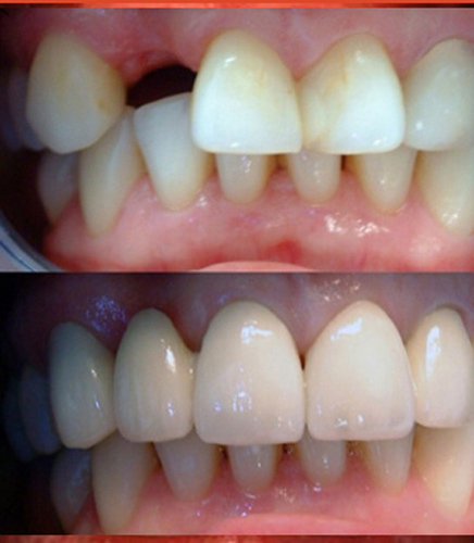 Clínica Dental Dra. Kenny Perero Pin 3