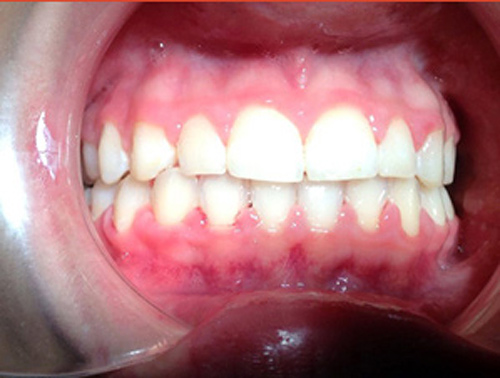 Clínica Dental Dra. Kenny Perero Pin 6