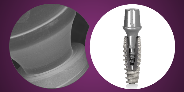 Clinica Dental Bilbident - Dentistas en Calatayud 7