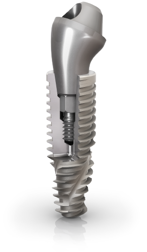 Clinica Dental Bilbident - Dentistas en Calatayud 11