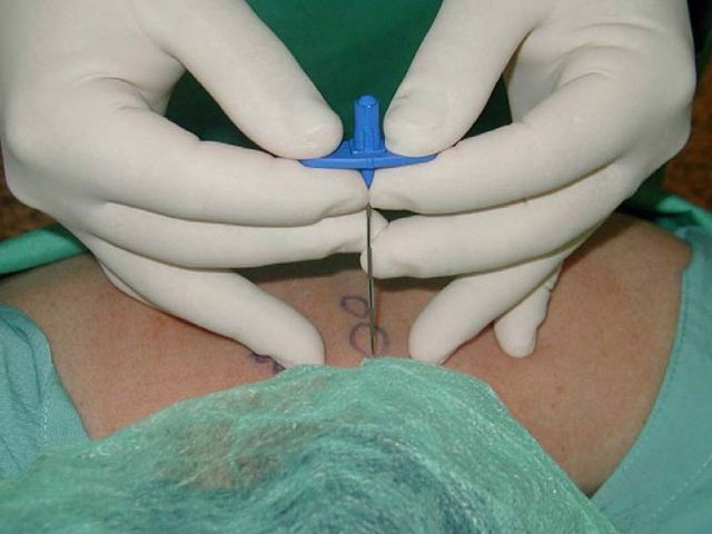 Clinica del Dolor Murcia 17