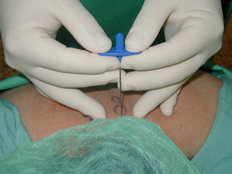 Clinica del Dolor Murcia 6