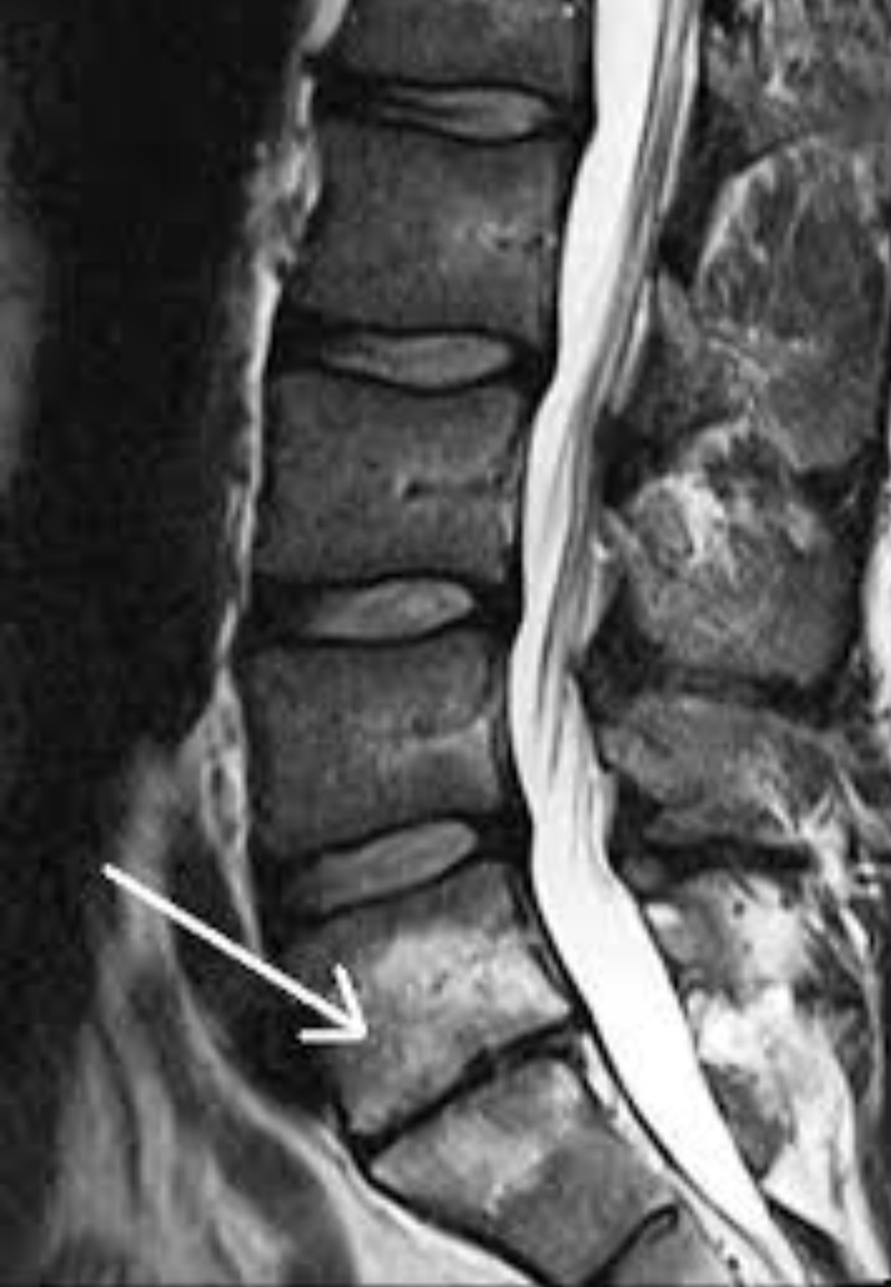 Fisioterapeuta Valencia 8