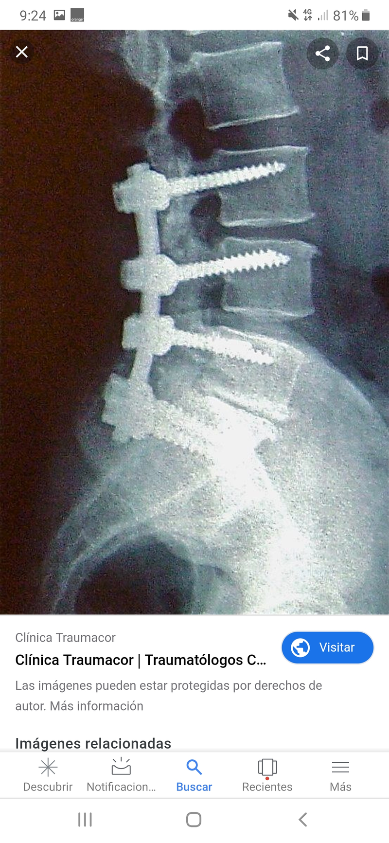 Fisioterapeuta Valencia 16