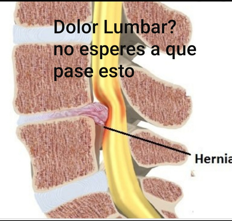 Fisioterapeuta Valencia 10