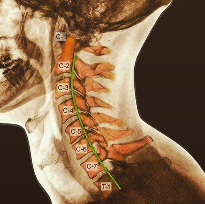 Fisioterapeuta Valencia 6