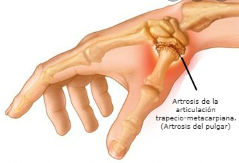 Fisioterapeuta Valencia 9