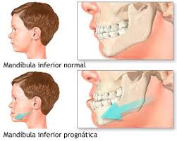 Imagen Maxilofacial Madrid Imagen Maxilofacial Madrid