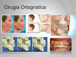 Imagen Maxilofacial 2 Imagen Maxilofacial 2