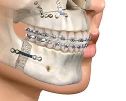Imagen Maxilofacial ODONTOLOGOS Y ESTOMATOLOGOS Imagen Maxilofacial ODONTOLOGOS Y ESTOMATOLOGOS