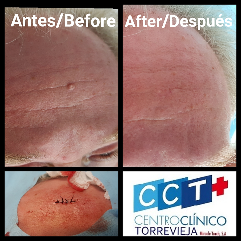 Centro Clínico Torrevieja 2