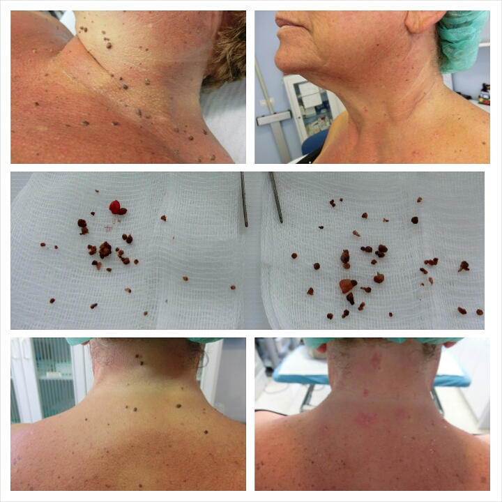 Centro Clínico Torrevieja Torrevieja