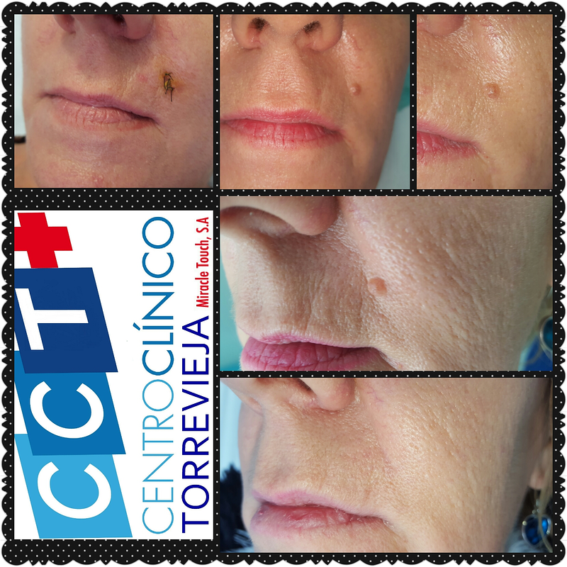 Centro Clínico Torrevieja 3