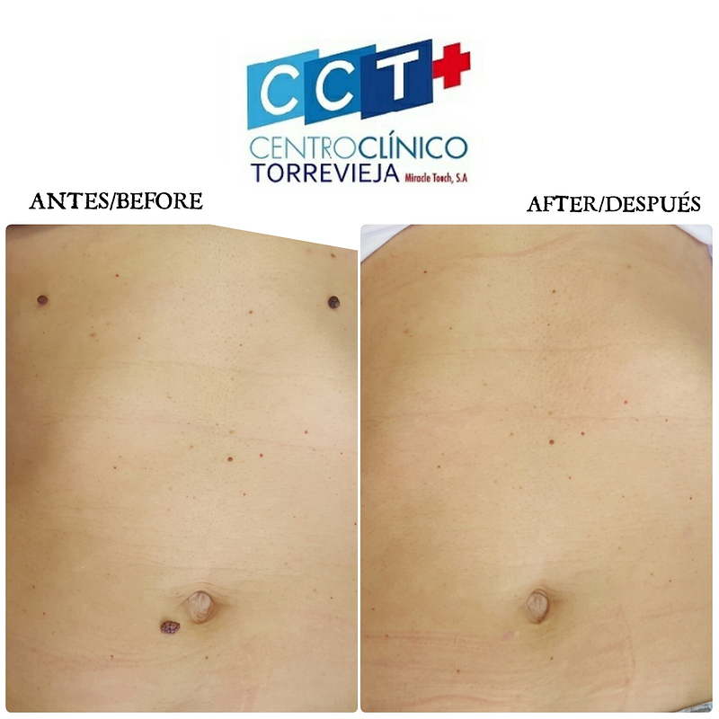 Centro Clínico Torrevieja CLINICAS MEDICAS