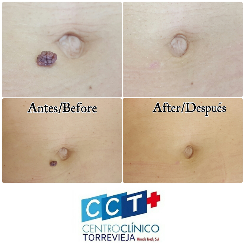 Centro Clínico Torrevieja 4