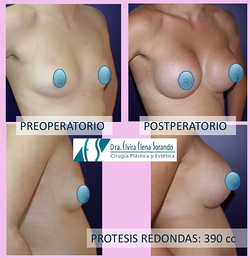 Dra. Elvira Elena Sorando MEDICOS ESPECIALISTAS CIRUGIA PLASTICA ESTETICA Y REPARADORA Dra. Elvira Elena Sorando MEDICOS ESPECIALISTAS CIRUGIA PLASTICA ESTETICA Y REPARADORA