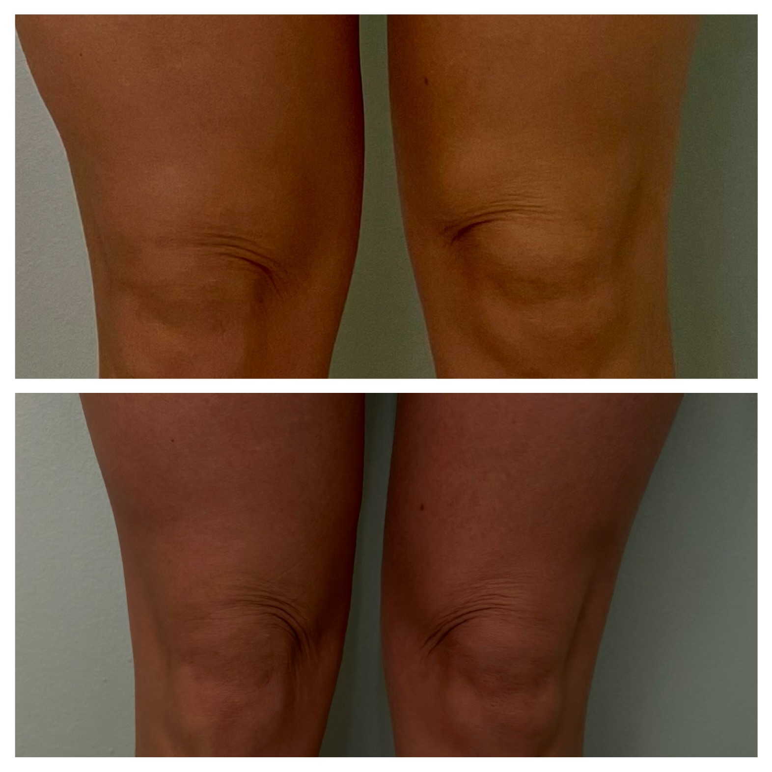 Velassaru Integral Aesthetic 19