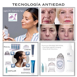 Galería de imágenes