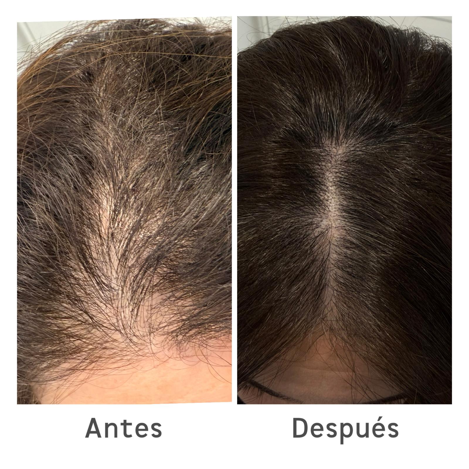 ProCapilHair 8