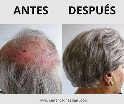 Galería de imágenes