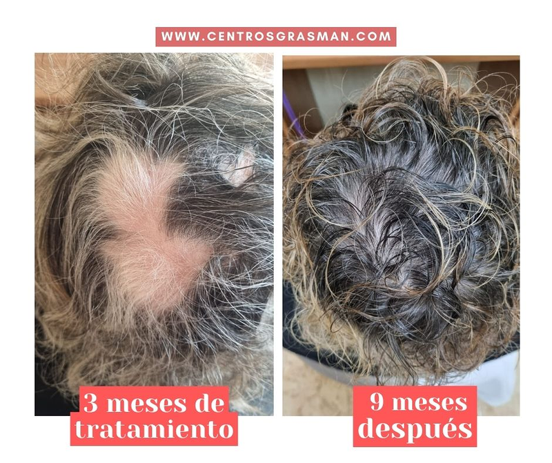 Grasman Centro Dermo-Capilar 6