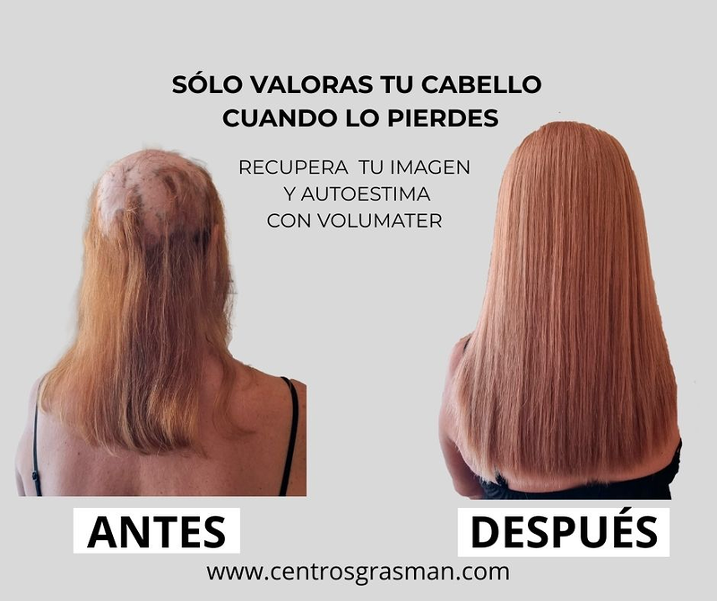 Grasman Centro Dermo-Capilar 10